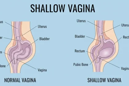 Shallow-Vagina