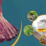 Top-5-Ayurvedic-Remedies-To-Lower-Uric-Acid-Naturally